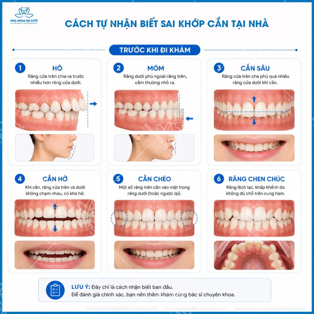 cach-nhan-biet