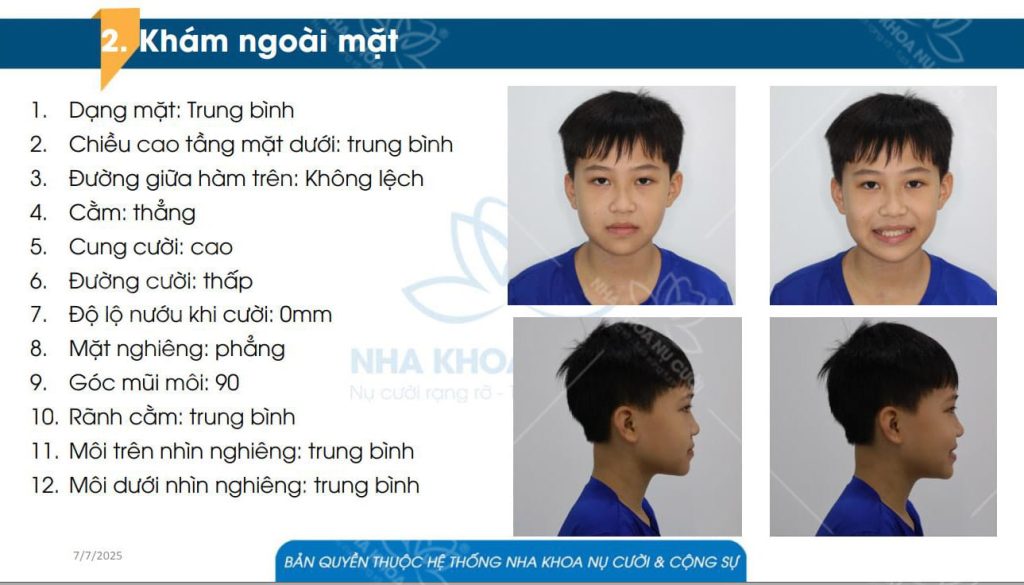 Tham-kham-tai-nha-khoa-nu-cuoi