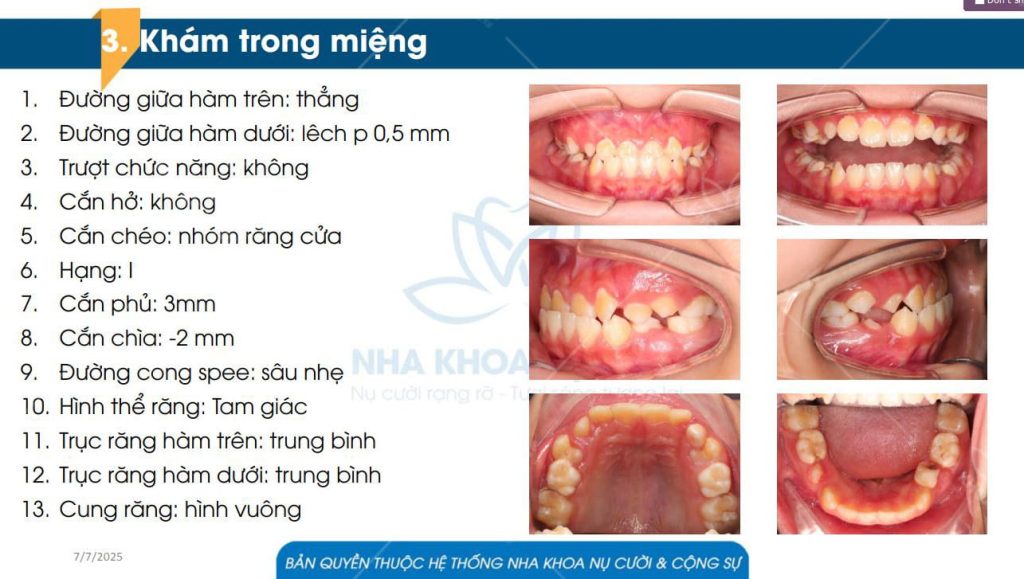 KHACH-HANG-NHA-KHOA-NU-CUOI-KHOP-CAN-HANG-III