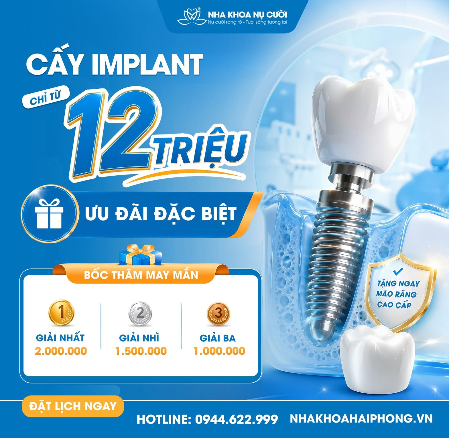 Tháng 7 – Ưu đãi trồng răng Implant hấp dẫn tại Nha Khoa Nụ Cười