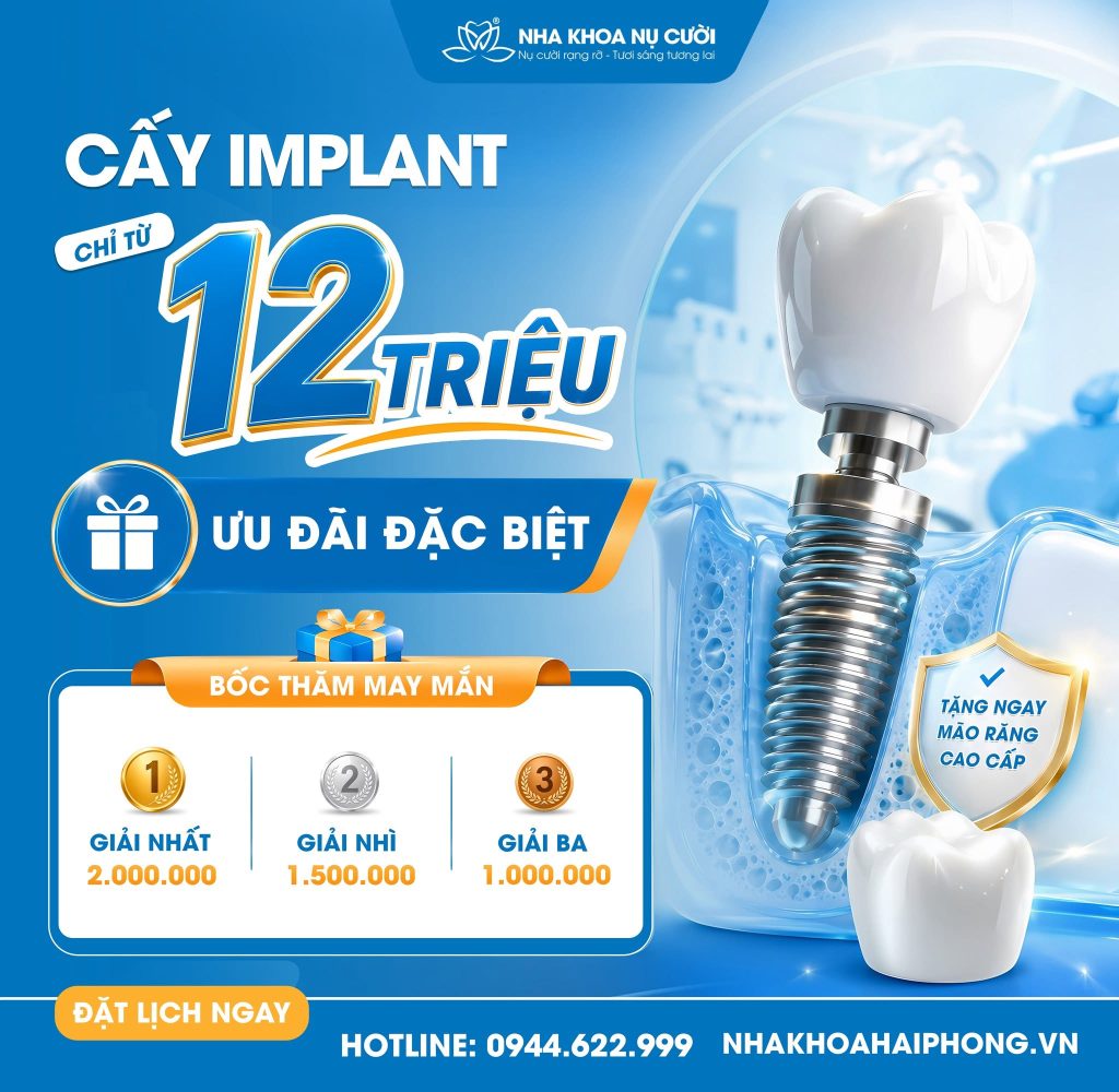 thang7-uu-dai-trong-rang-implant
