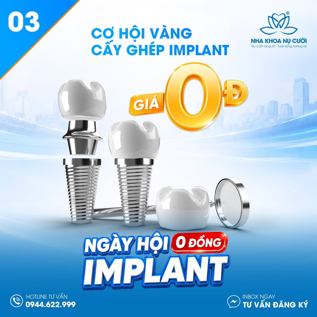 ngay-hoi-implant-thuy-nguyen-hai-phong