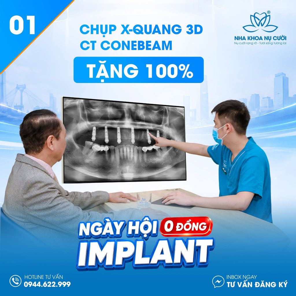 ngay-hoi-implant-thuy-nguyen-hai-phong