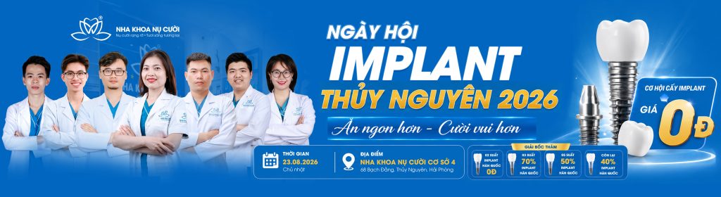 ngay-hoi-trong-rang-implant-thuy-nguyen-2026