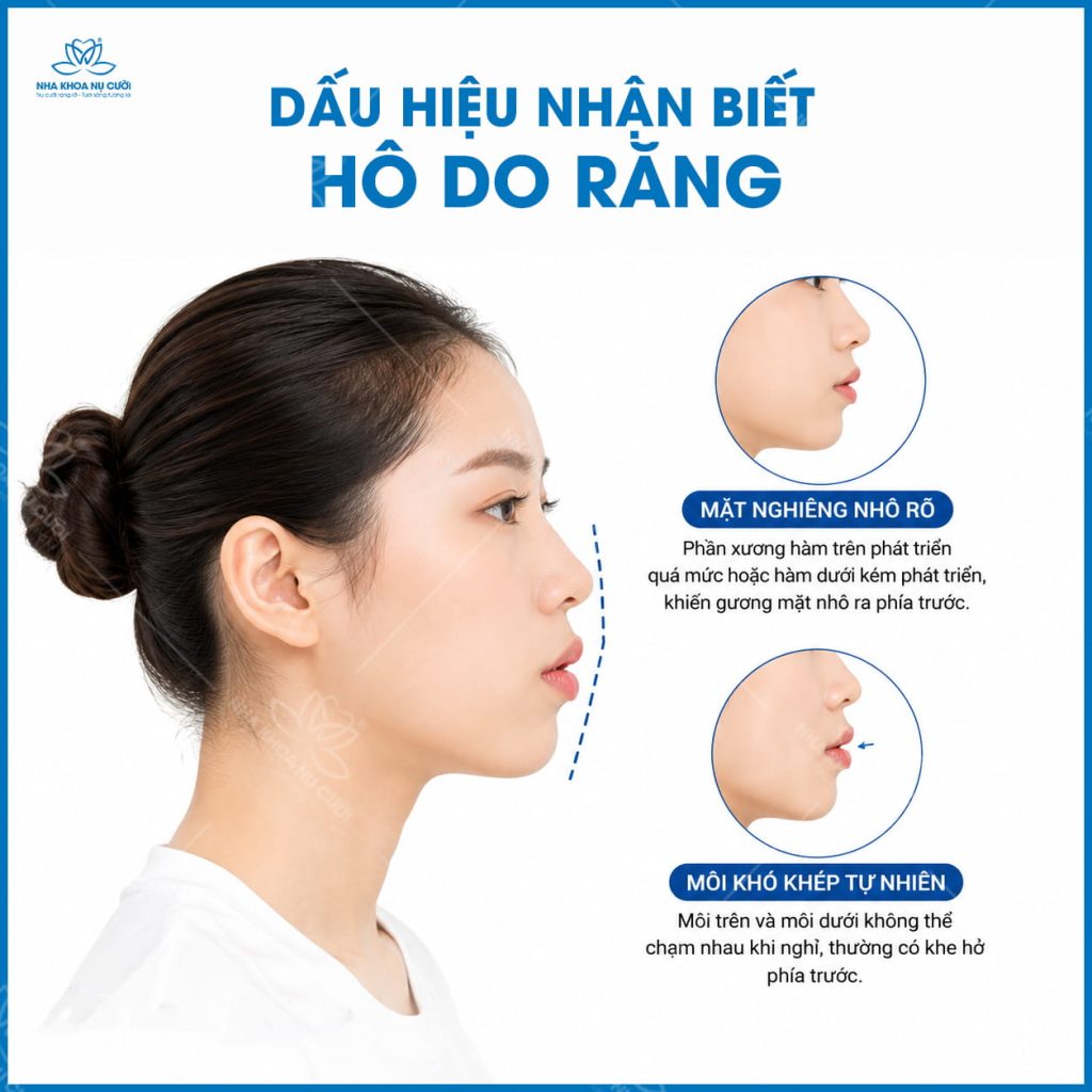 DAU-HIEU-NHAN-BIET-HO-DO-RANG