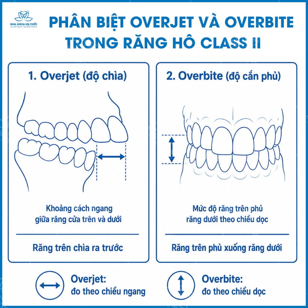 phan-biet-overjet-overbite-trong-rang-ho- Class II