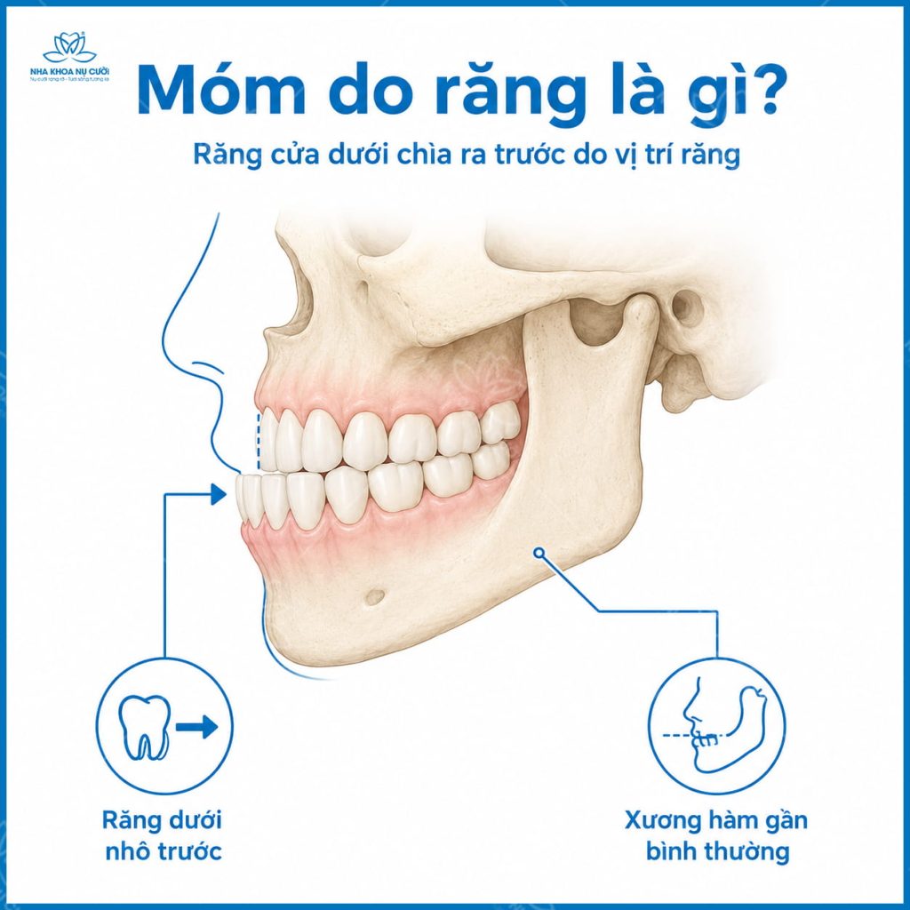 mom-do-rang-va-mom-do-xuong-hai-phong