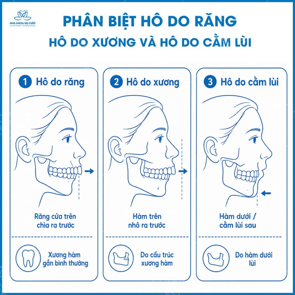 phan-biet