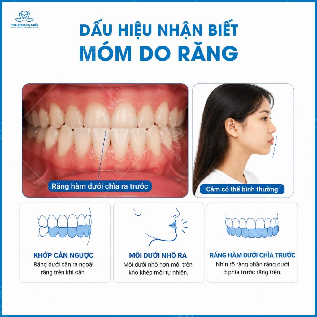 dau-hieu-mom-do-rang-va-mom-do-xuong-hai-phong