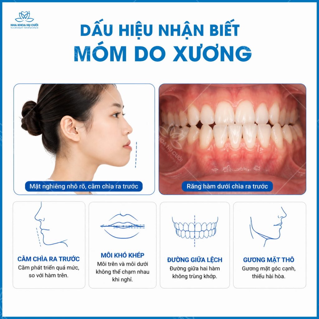 dau-hieu-mom-do-rang-va-mom-do-xuong-hai-phong