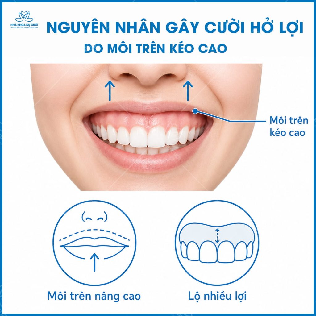 nguyen-nhan