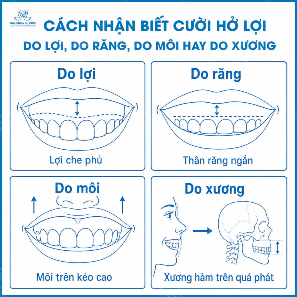 cach-nhan-biet-cuoi-ho-loi