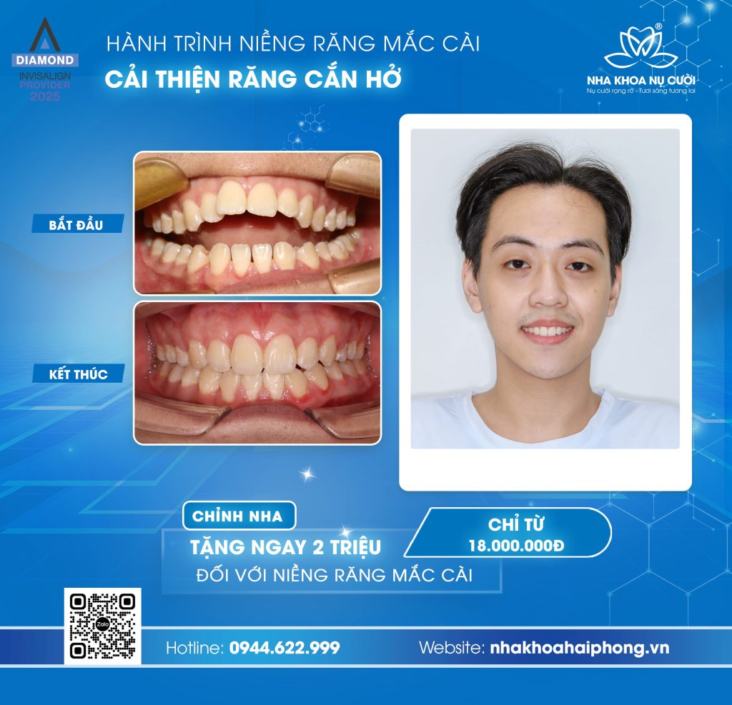 khop-can-ho-hai-phong