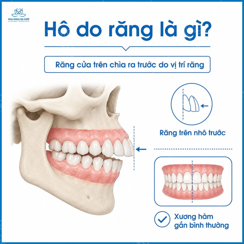 ho-do-rang