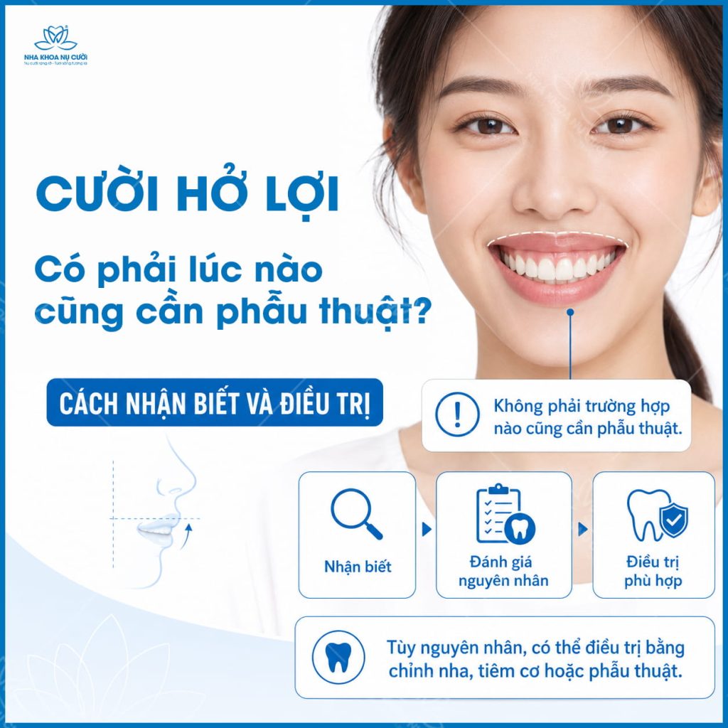 Cuoi-ho-loi-hai-phong