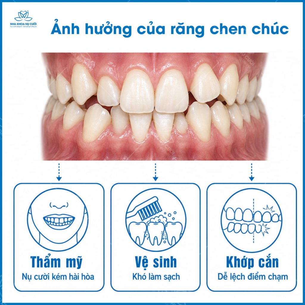 anh-huong-rang-chen-chuc