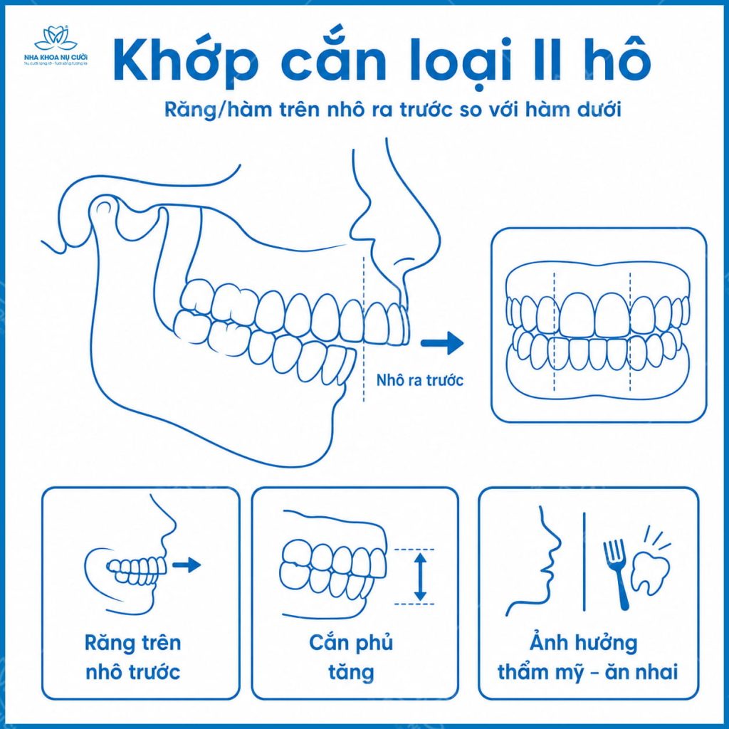 sai-khop-can-loai-II