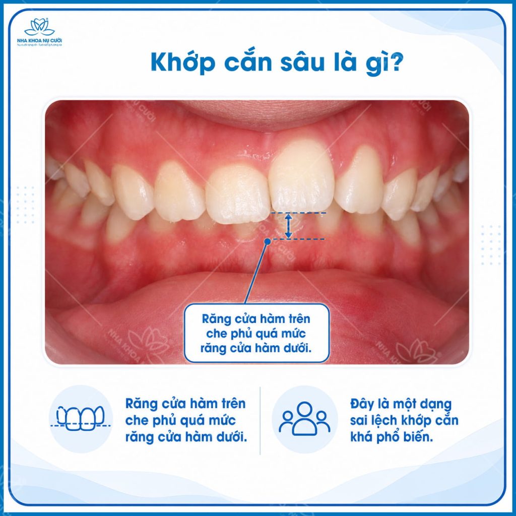 khop-can-sau-hai-phong
