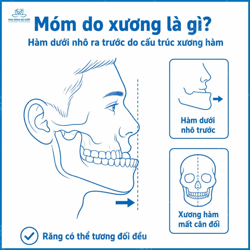 mom-do-rang-va-mom-do-xuong-hai-phong