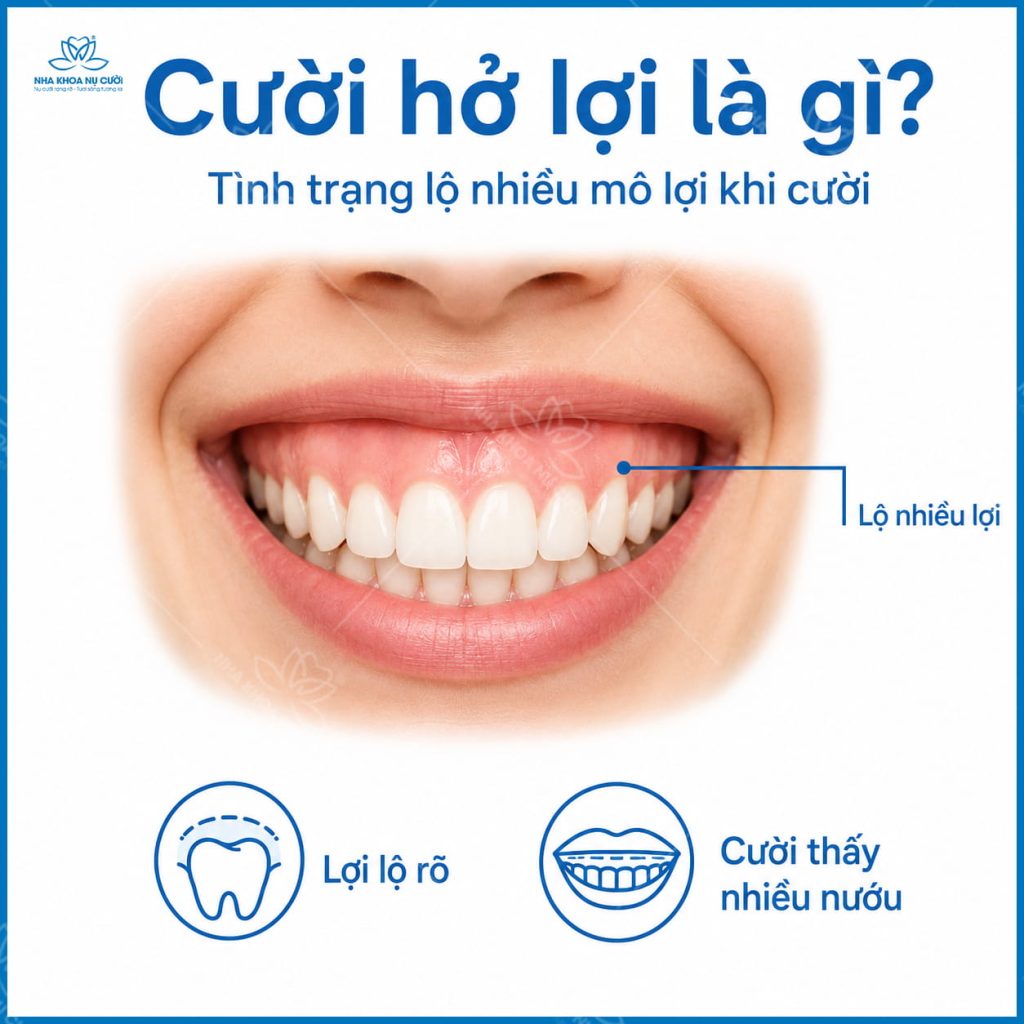 Cuoi-ho-loi-hai-phong