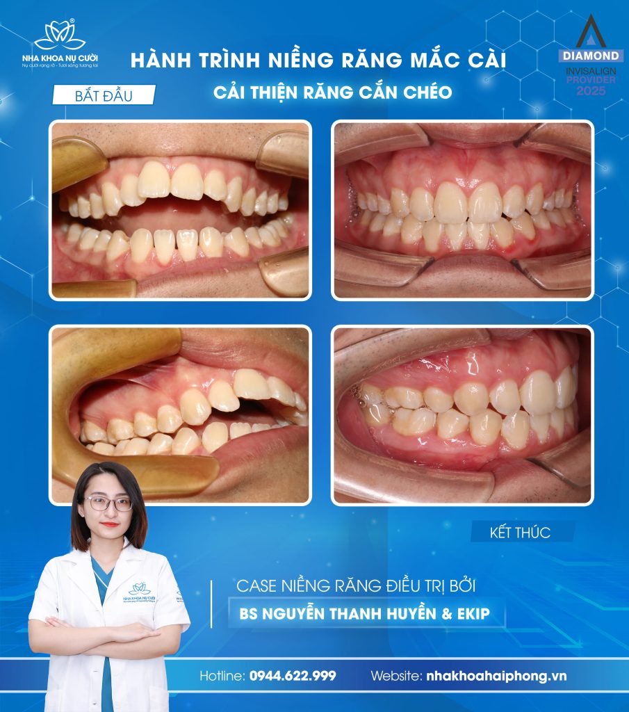 anh-khach-hang-le-nguyen-hoang