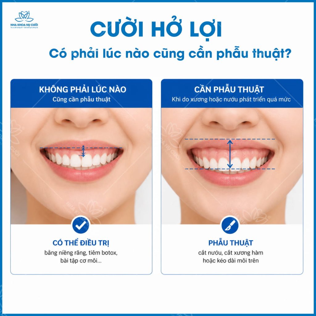 Cuoi-ho-loi-c0-can-phau-thuat-hai-phong