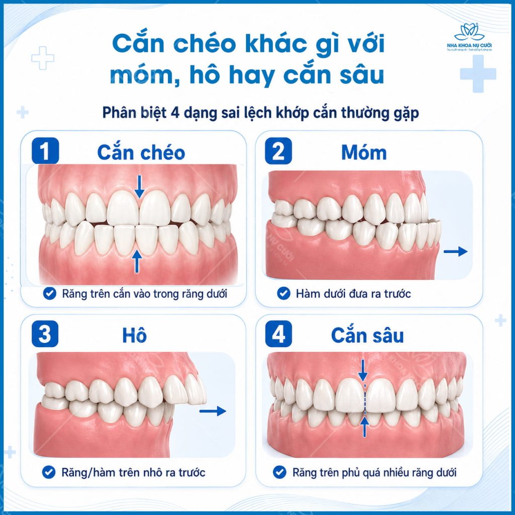 phan-biet-khop-can