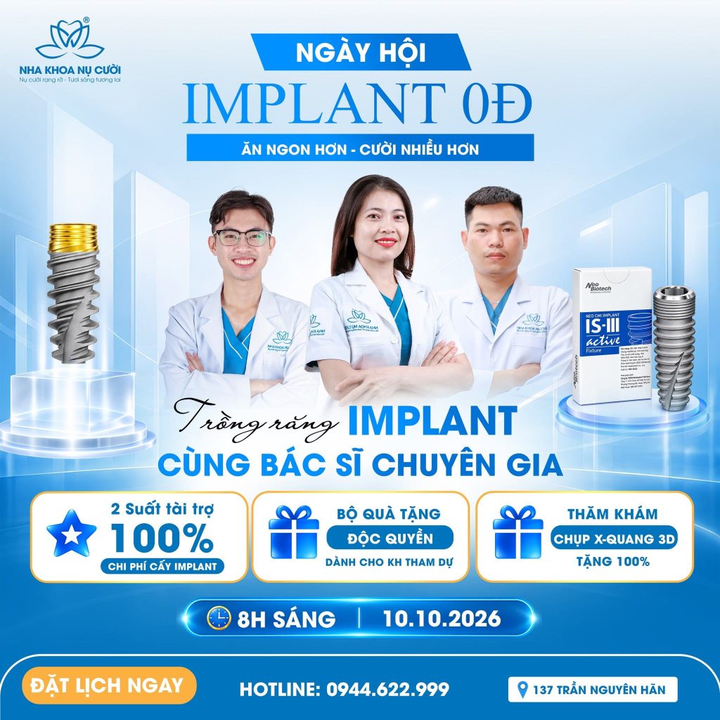 ngay-hoi-cay-ghep-implant-0D-nha-khoa-nu-cuoi-tran-nguyen-han