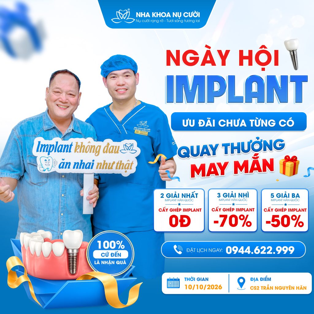 ngay-hoi-cay-ghep-implant-0D-nha-khoa-nu-cuoi-tran-nguyen-han