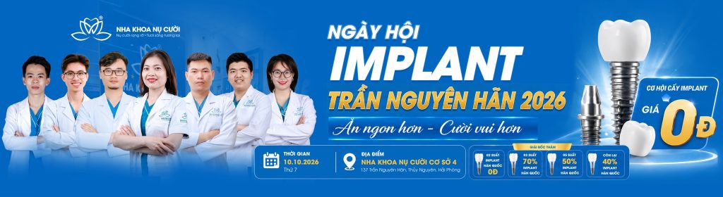 ngay-hoi-cay-ghep-implant-0D-nha-khoa-nu-cuoi-tran-nguyen-han